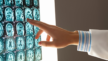 A medical professional indicates a brain scan on a monitor